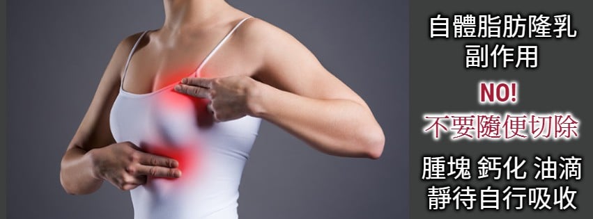 自體脂肪隆乳副作用是什麼？處理方式為何?