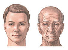 老化會使臉部脂肪流失
